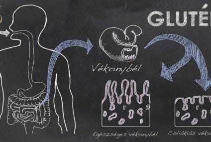 Lisztérzékenység, glutén, glutamin